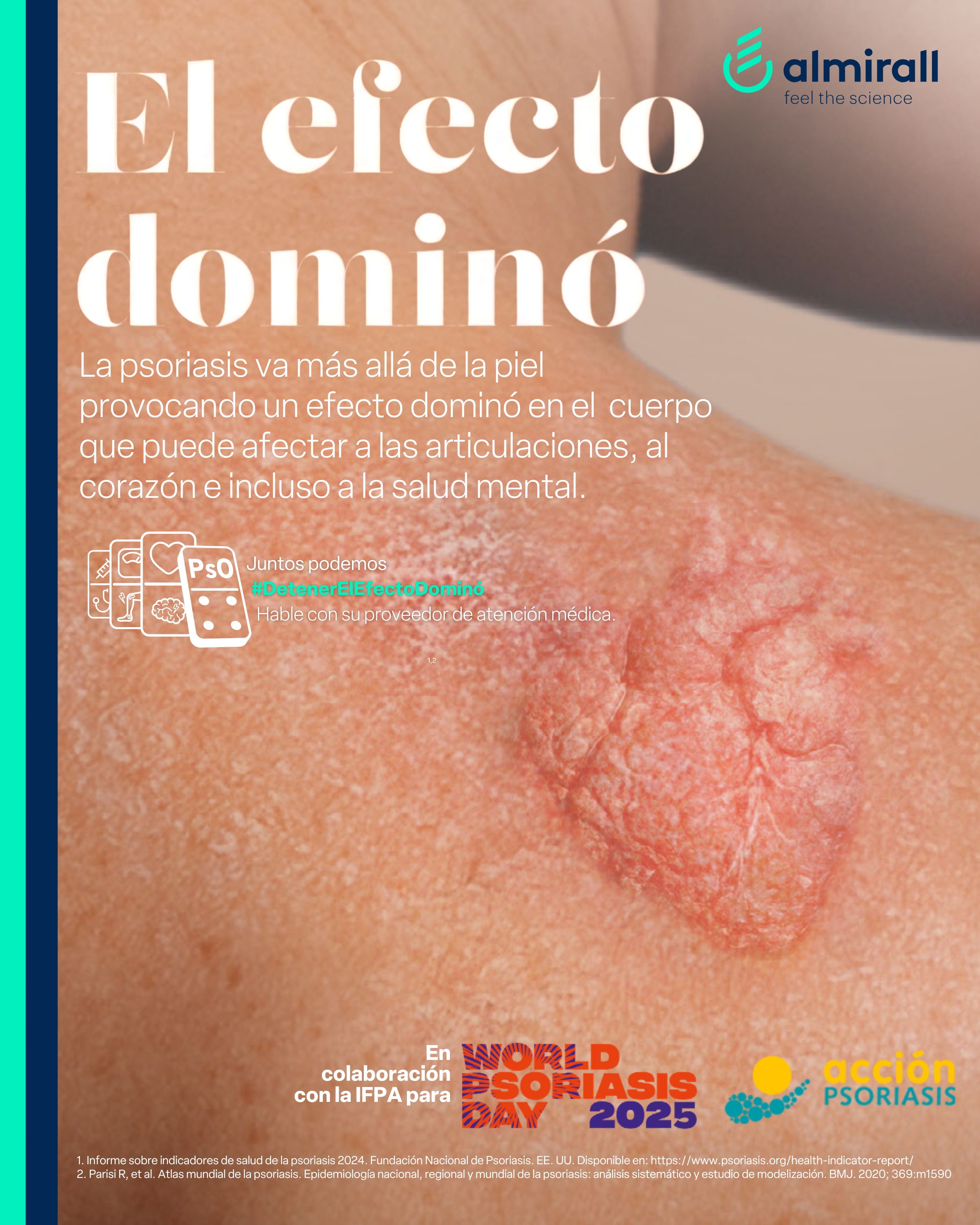 Día Mundial Psoriasis